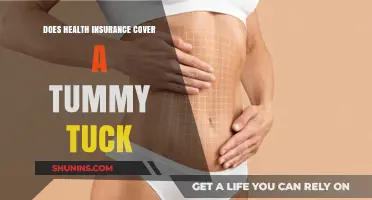 Does Health Insurance Cover Tummy Tucks? What You Need to Know