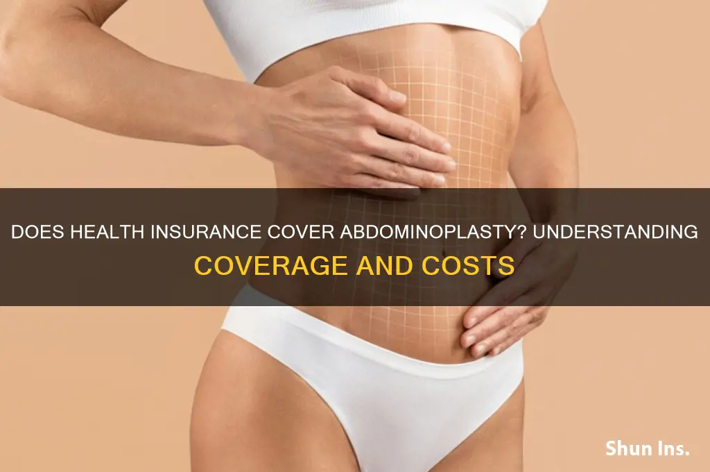 does health insurance cover abdominoplasty