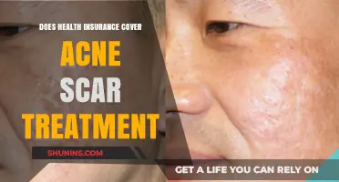 Does Health Insurance Cover Acne Scar Treatment? What You Need to Know