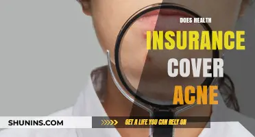 Does Health Insurance Cover Acne Treatment? What You Need to Know