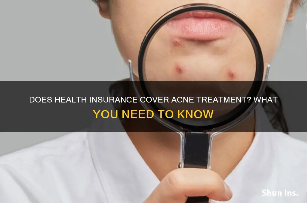 does health insurance cover acne