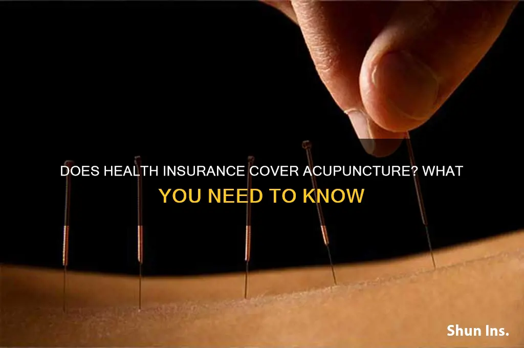 does health insurance cover acupuncture