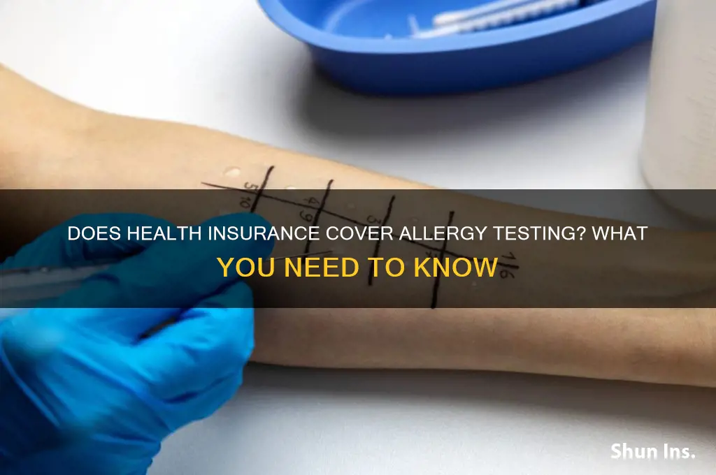 does health insurance cover allergy testing