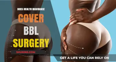 Does Health Insurance Cover BBL Surgery? What You Need to Know