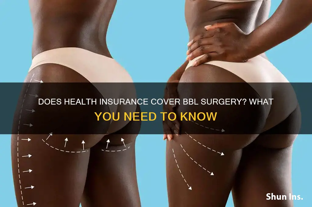 does health insurance cover bbl surgery