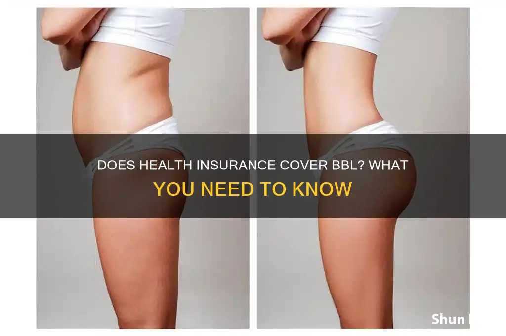 does health insurance cover bbl