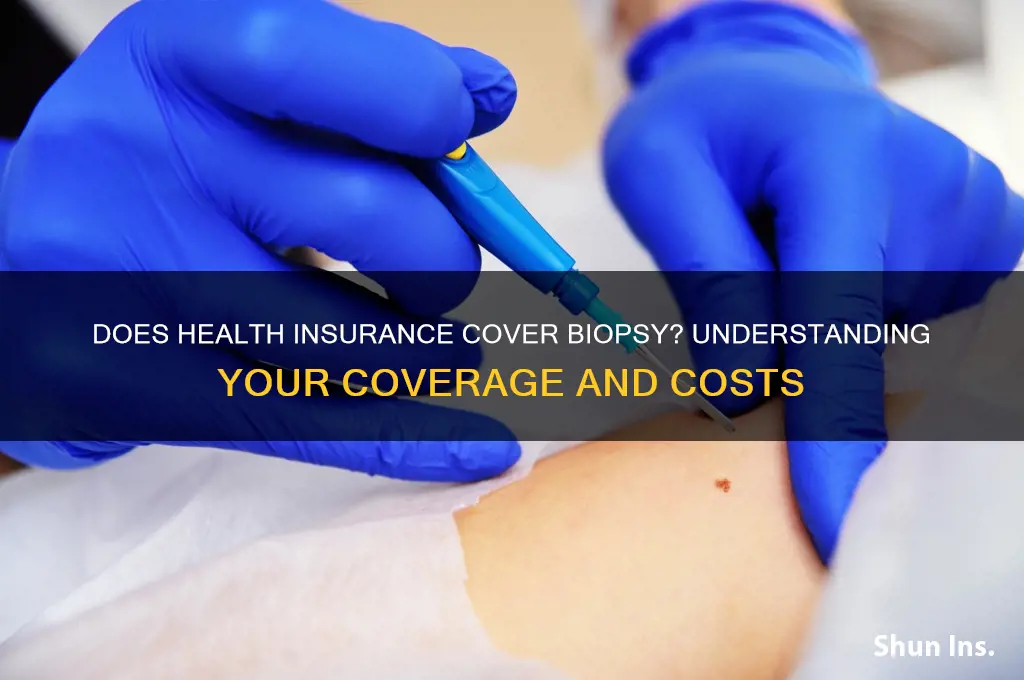 does health insurance cover biopsy