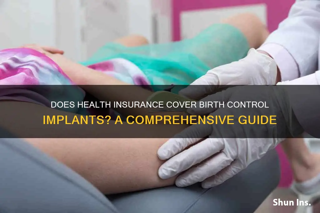 does health insurance cover birth control implant