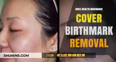 Does Health Insurance Cover Birthmark Removal? What You Need to Know