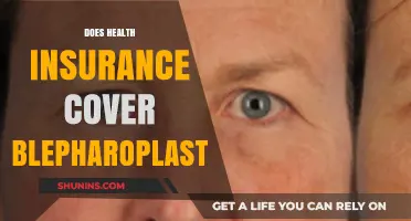 Does Health Insurance Cover Blepharoplasty? Understanding Coverage and Costs