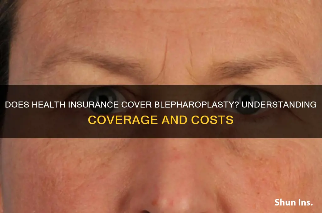 does health insurance cover blepharoplasty
