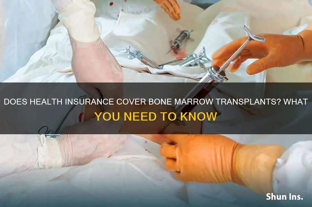 does health insurance cover bone marrow transplant