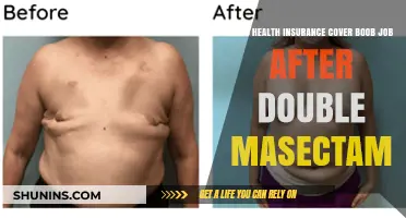 Health Insurance Coverage for Breast Reconstruction Post-Double Mastectomy