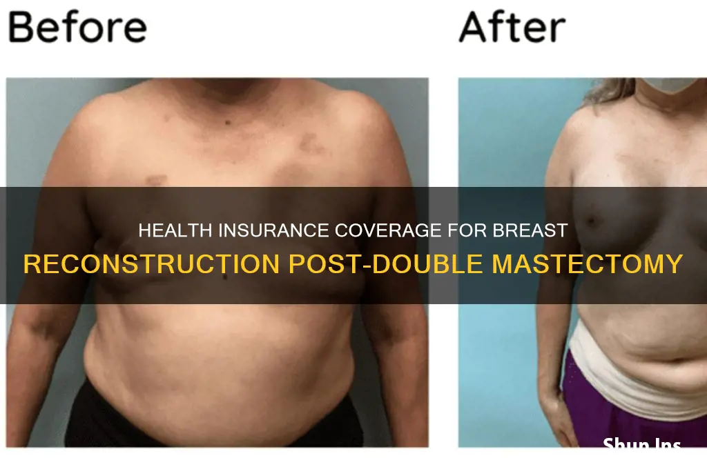 does health insurance cover boob job after double masectamy