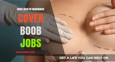Does Health Insurance Cover Breast Augmentation? What You Need to Know