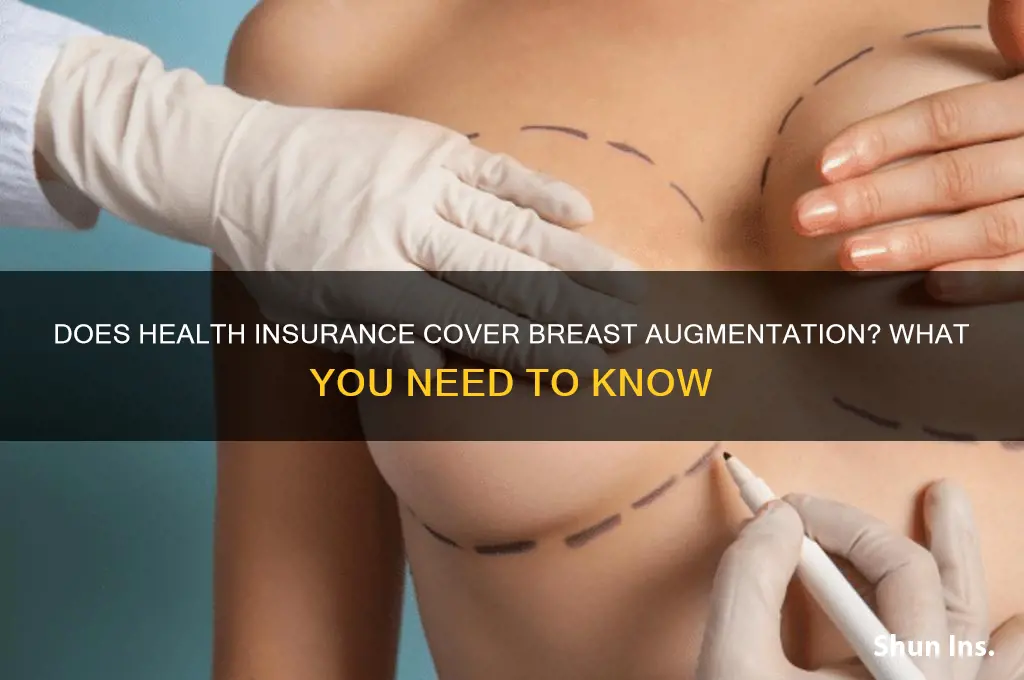 does health insurance cover boob jobs