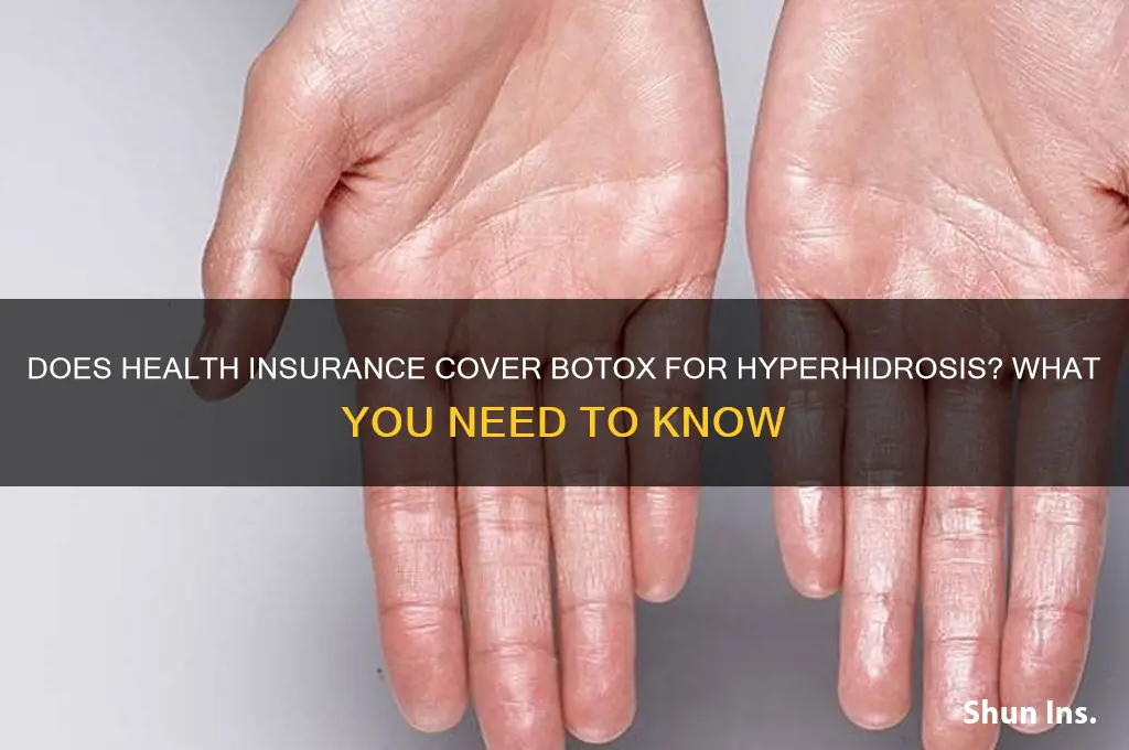 does health insurance cover botox for hyperhidrosis