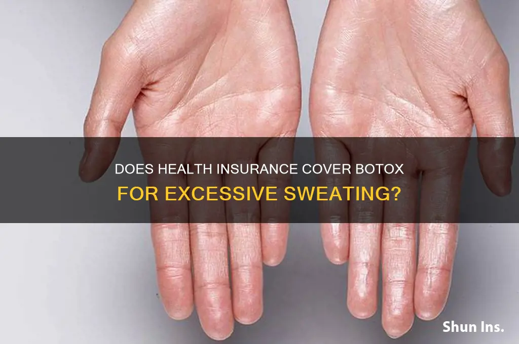 does health insurance cover botox for sweating