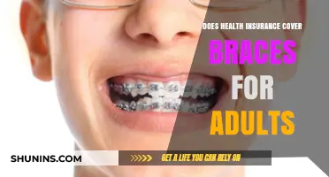 Adult Braces Coverage: What Health Insurance Plans Typically Include