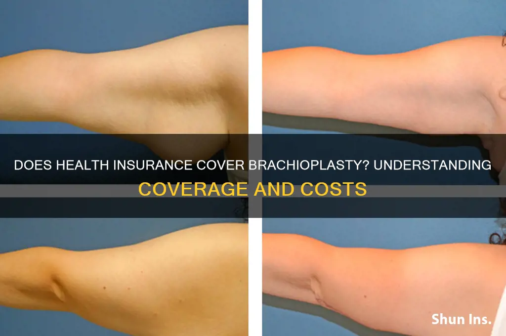 does health insurance cover brachioplasty
