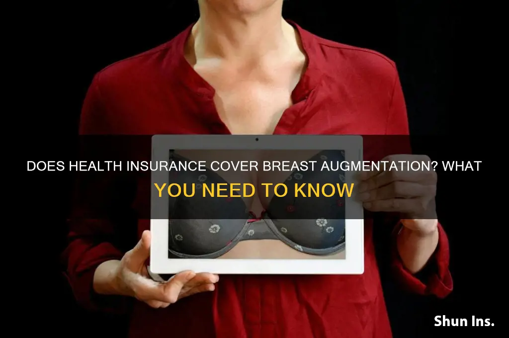 does health insurance cover breast augmentation