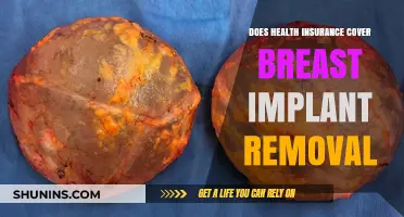 Does Health Insurance Cover Breast Implant Removal? What You Need to Know