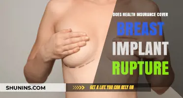 Does Health Insurance Cover Breast Implant Rupture? What You Need to Know