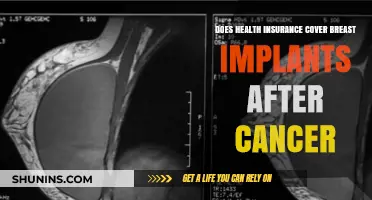Health Insurance Coverage for Breast Implants Post-Cancer: What’s Included?