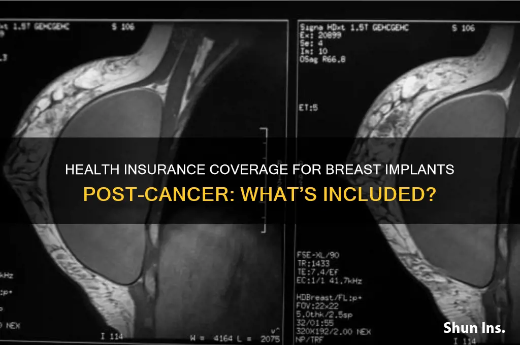 does health insurance cover breast implants after cancer