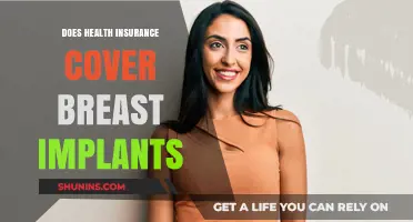 Does Health Insurance Cover Breast Implants? What You Need to Know