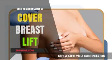 Does Health Insurance Cover Breast Lift Procedures? What You Need to Know