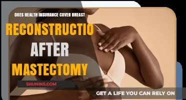 Health Insurance Coverage for Breast Reconstruction Post-Mastectomy: What’s Included?