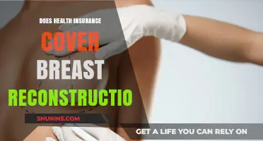 Does Health Insurance Cover Breast Reconstruction? What You Need to Know