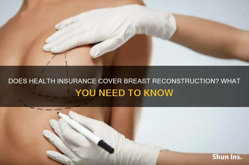 does health insurance cover breast reconstruction