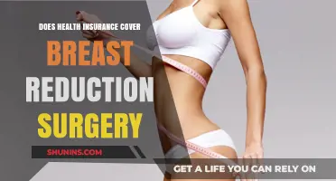 Does Health Insurance Cover Breast Reduction Surgery? What You Need to Know