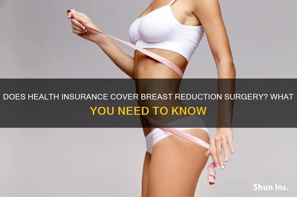 does health insurance cover breast reduction surgery