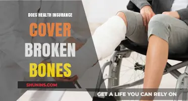Does Health Insurance Cover Broken Bones? What You Need to Know