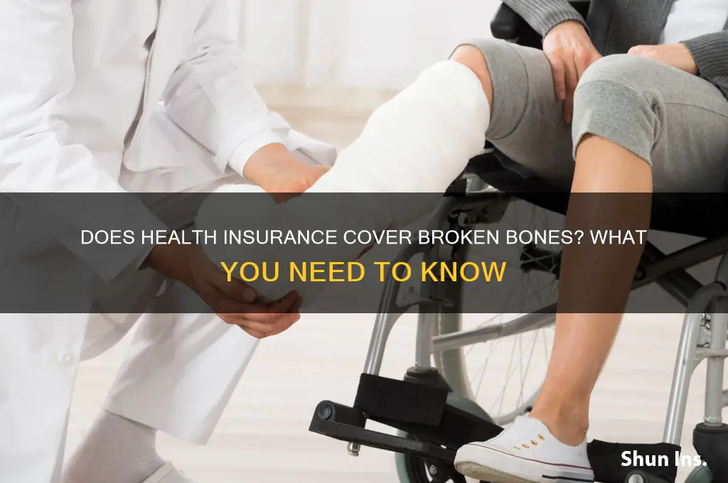 does health insurance cover broken bones