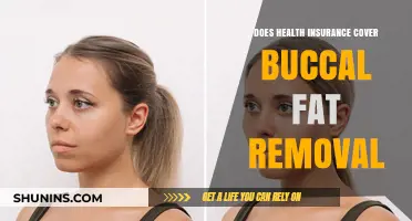 Does Health Insurance Cover Buccal Fat Removal? What You Need to Know