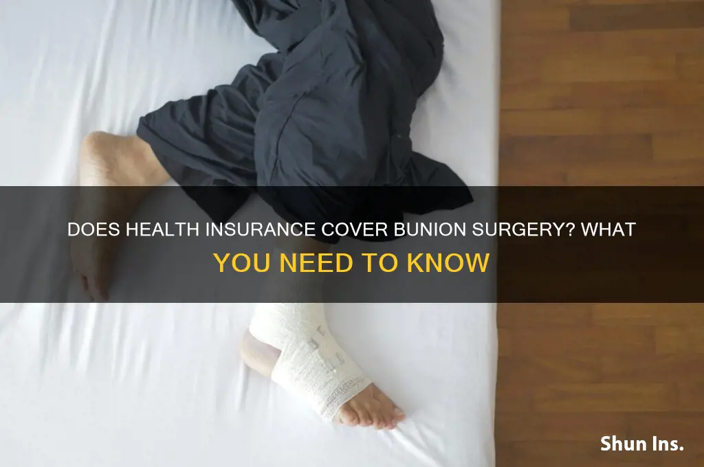 does health insurance cover bunion surgery