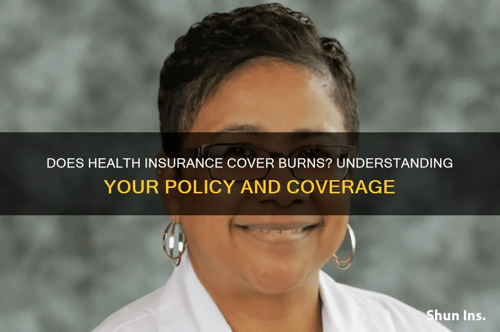 does health insurance cover burns