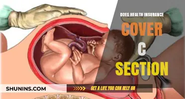 Does Health Insurance Cover C-Section? What You Need to Know
