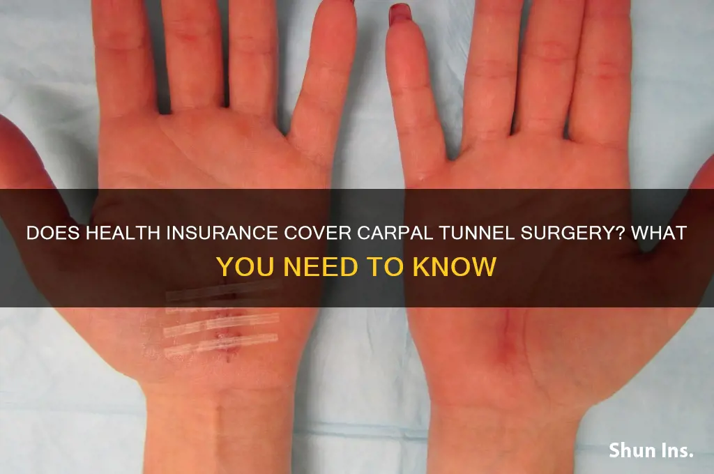 does health insurance cover carpal tunnel surgery
