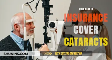 Does Health Insurance Cover Cataract Surgery? What You Need to Know