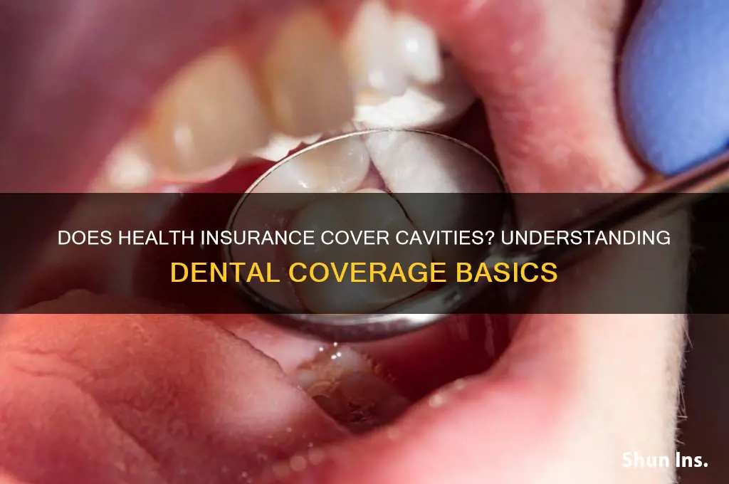 does health insurance cover cavities
