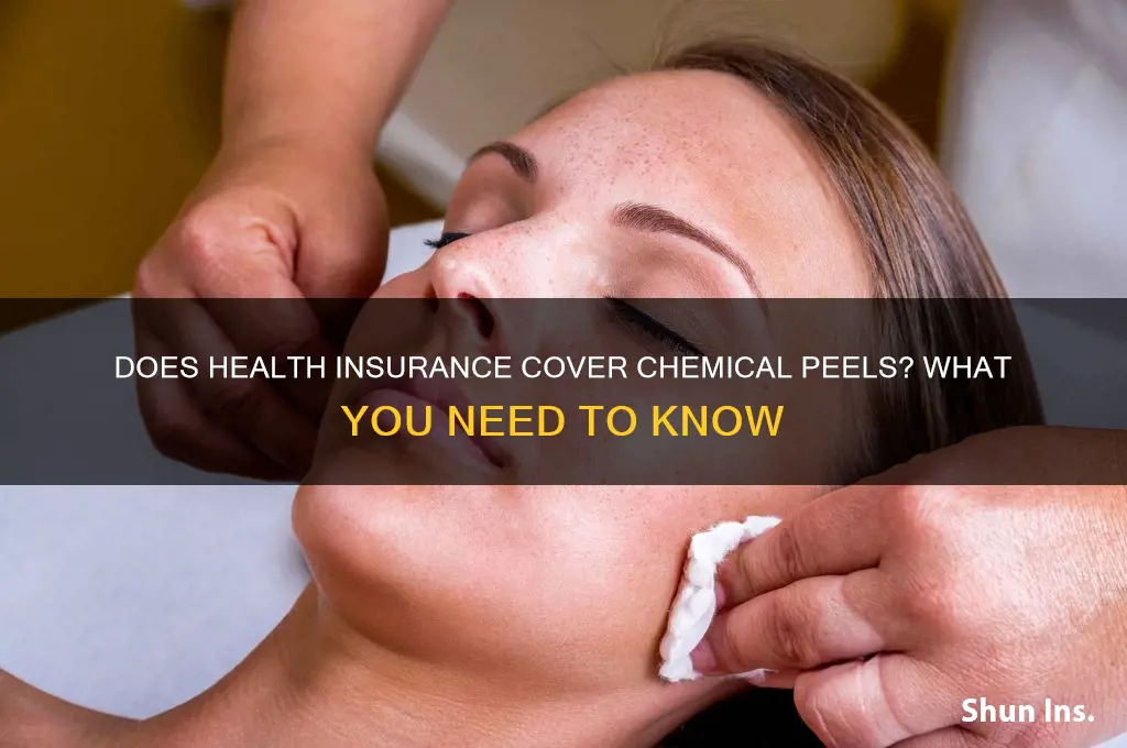 does health insurance cover chemical peels