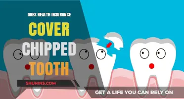 Chipped Tooth Coverage: What Your Health Insurance May or May Not Cover