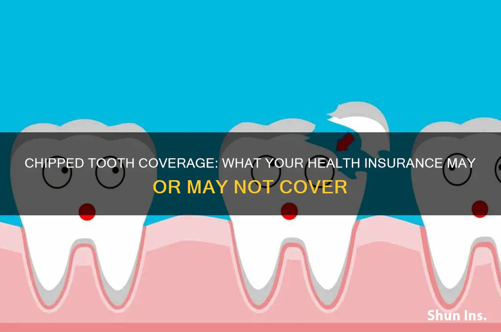does health insurance cover chipped tooth