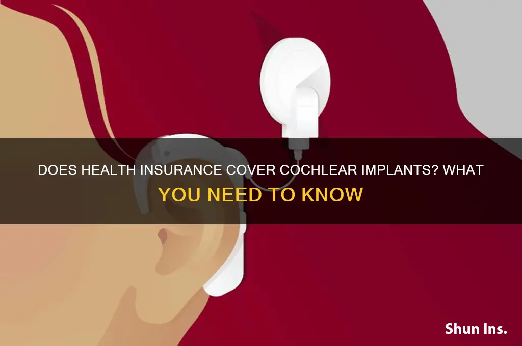 does health insurance cover cochlear implants