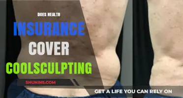 Does Health Insurance Cover CoolSculpting? What You Need to Know